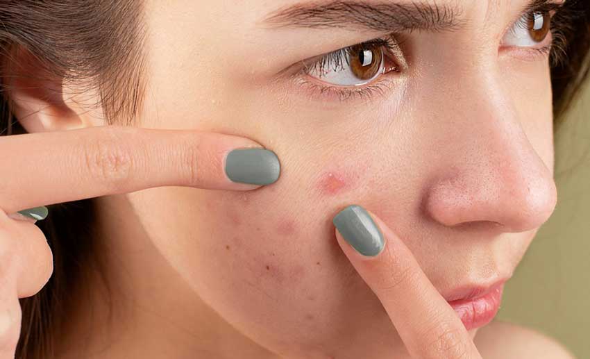 Dr. Yeung Ho Hong(楊浩康) explains Acne treatment - isotretinoin
